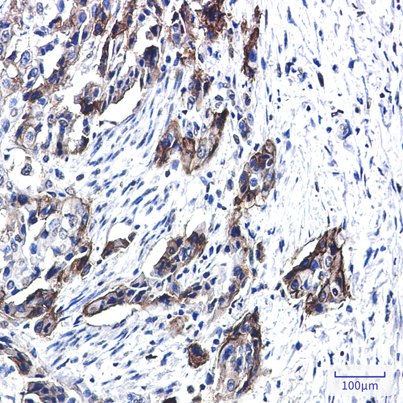 Anti-Tissue Factor Rabbit mAb [83M71K67]