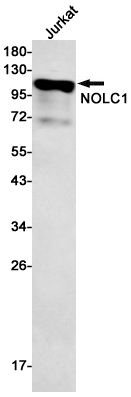 Anti-NOLC1 Rabbit mAb [90K32L53]