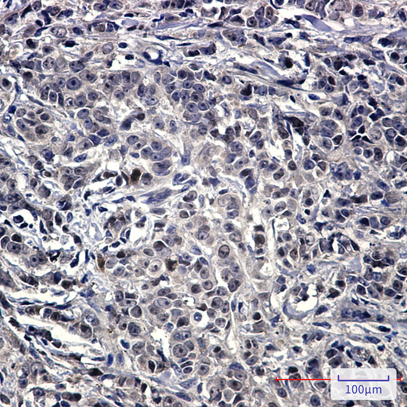 Anti-NOLC1 Rabbit mAb [90K32L53]