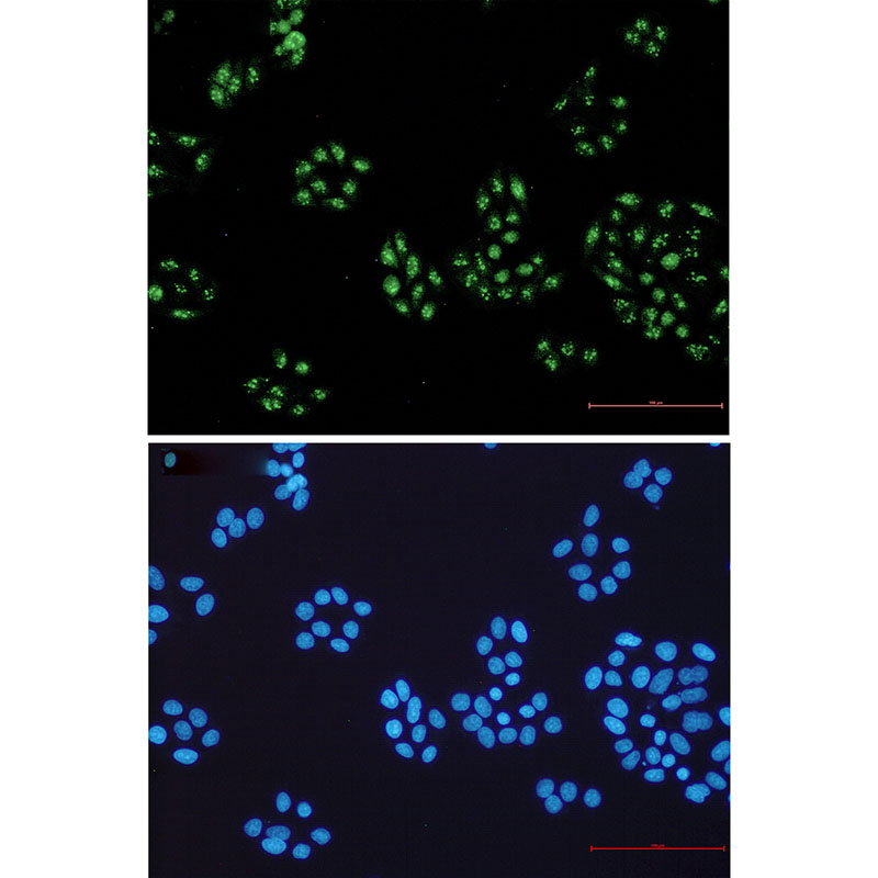 Anti-NOLC1 Rabbit mAb [90K32L53]