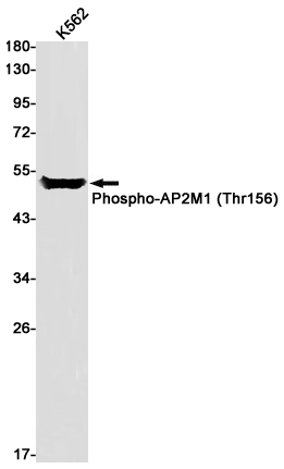 Anti-Phospho-AP2M1 (Thr156) Rabbit mAb [83M63K45]