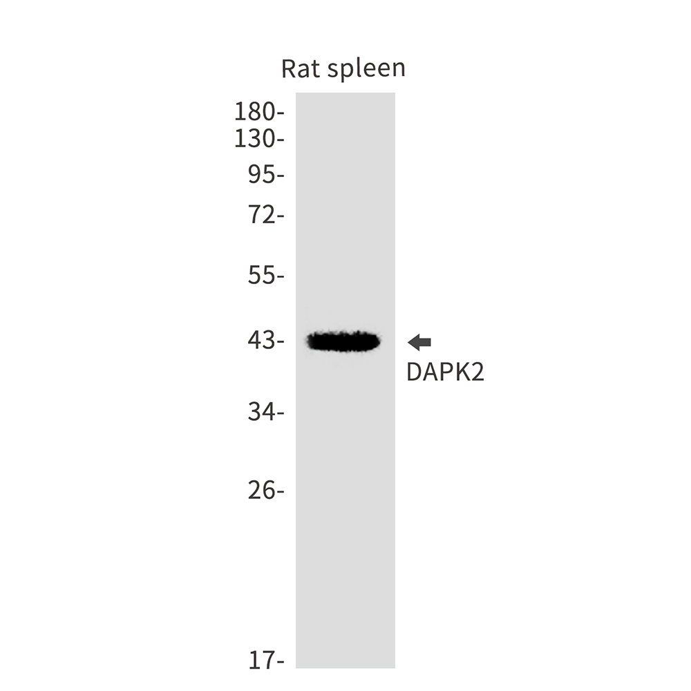 Anti-DAPK2 Rabbit mAb [41M10M58]