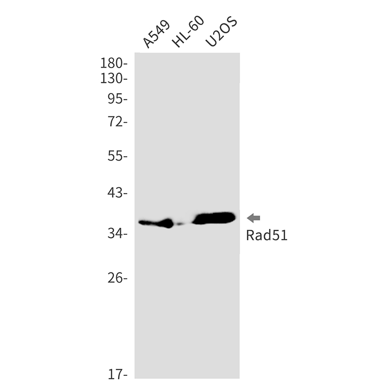 Anti-Rad51 Rabbit mAb [62K10L91]