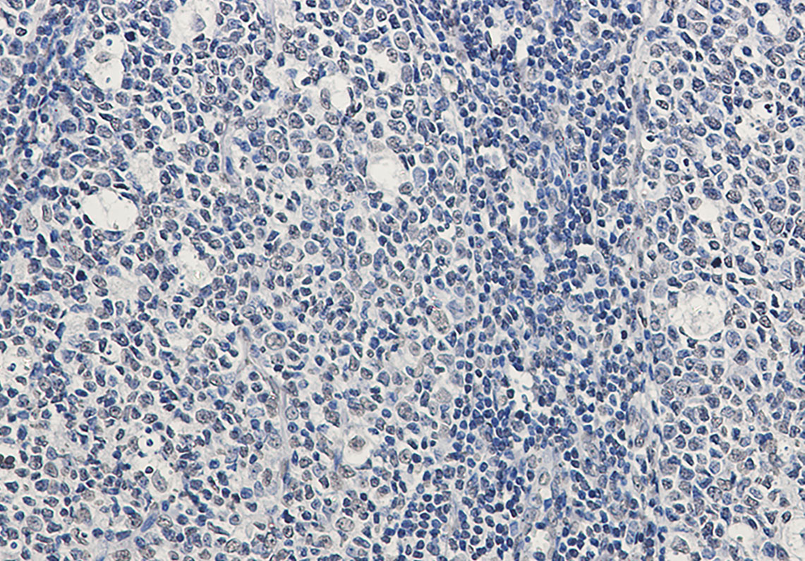 Anti-Rad51 Rabbit mAb [62K10L91]