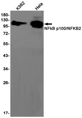 Anti-NF-KB p100 Rabbit mAb [98L22L08]