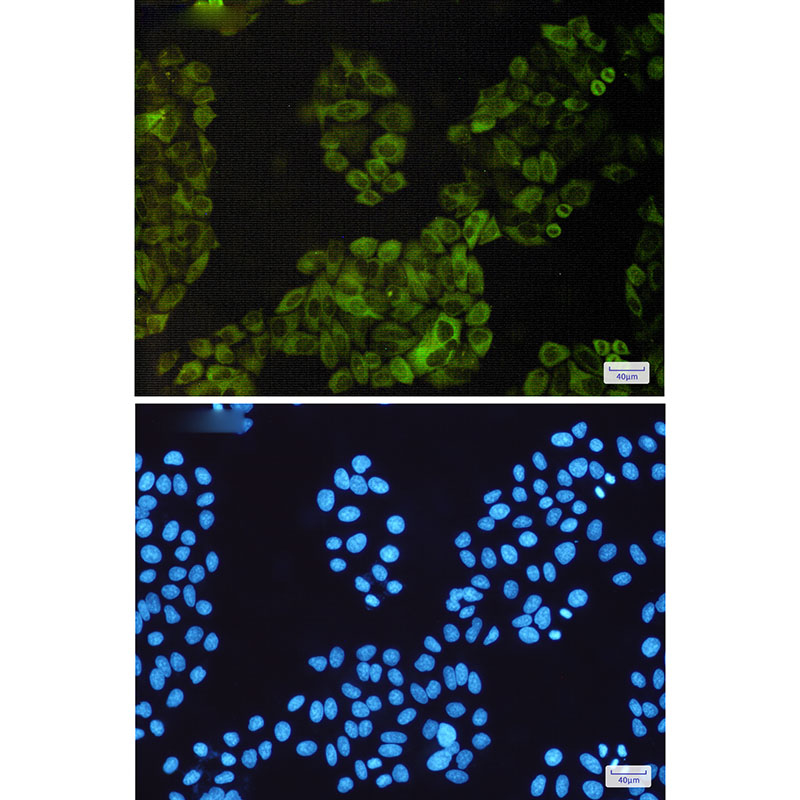 Anti-NF-KB p100 Rabbit mAb [98L22L08]
