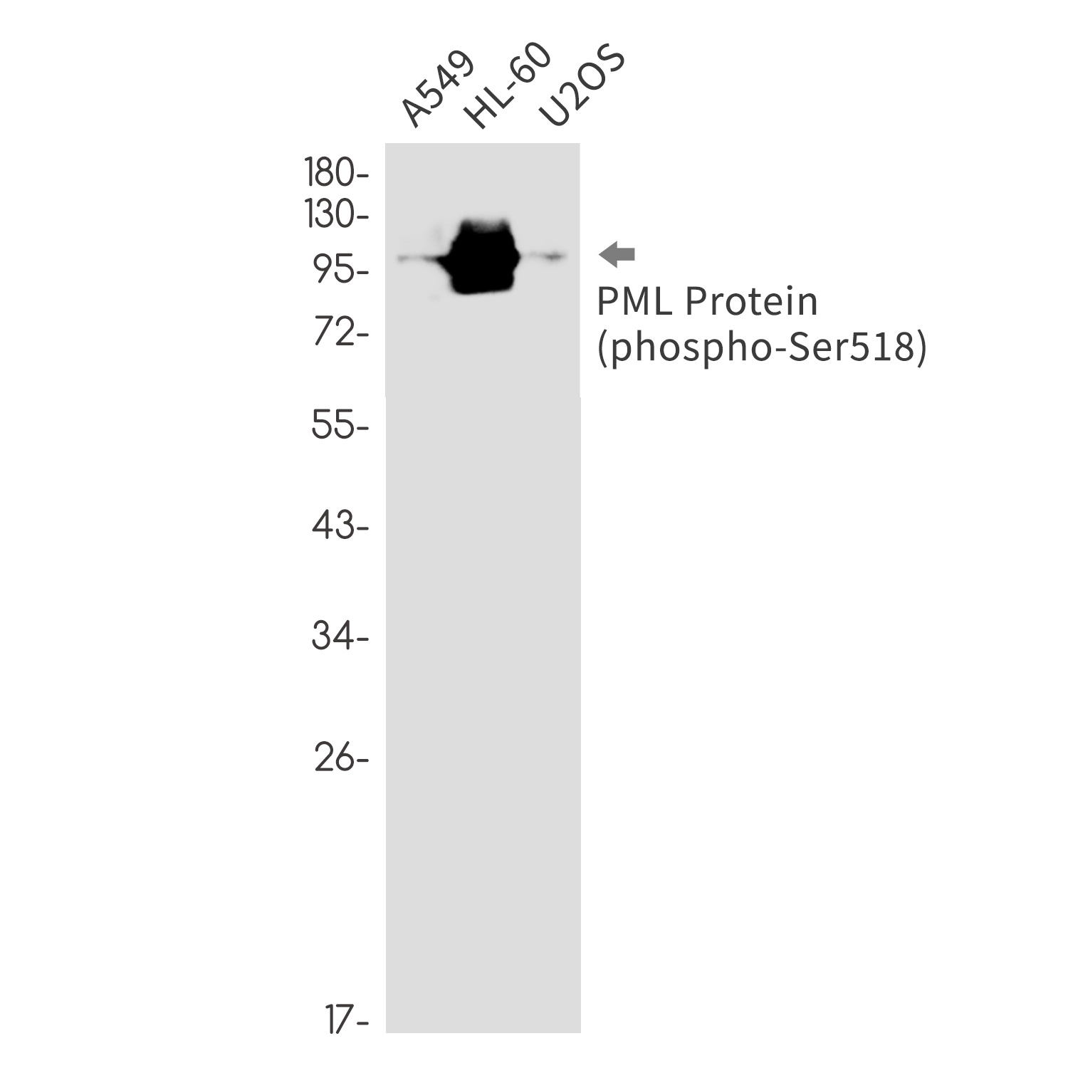 Anti-Phospho-PML Protein (Ser518) Rabbit mAb [95M88M74]