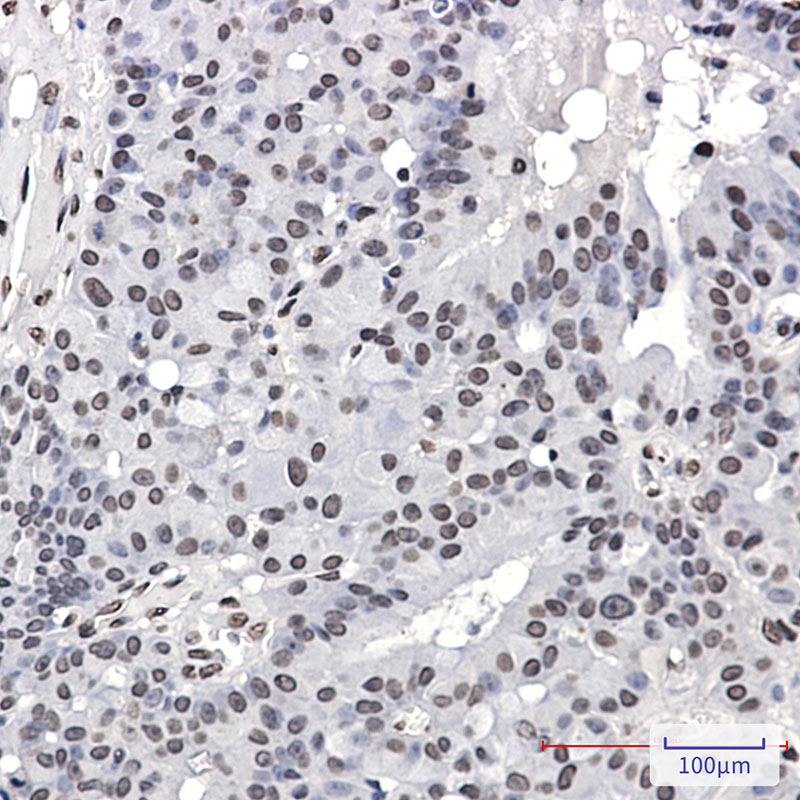 Anti-Phospho-PML Protein (Ser518) Rabbit mAb [95M88M74]