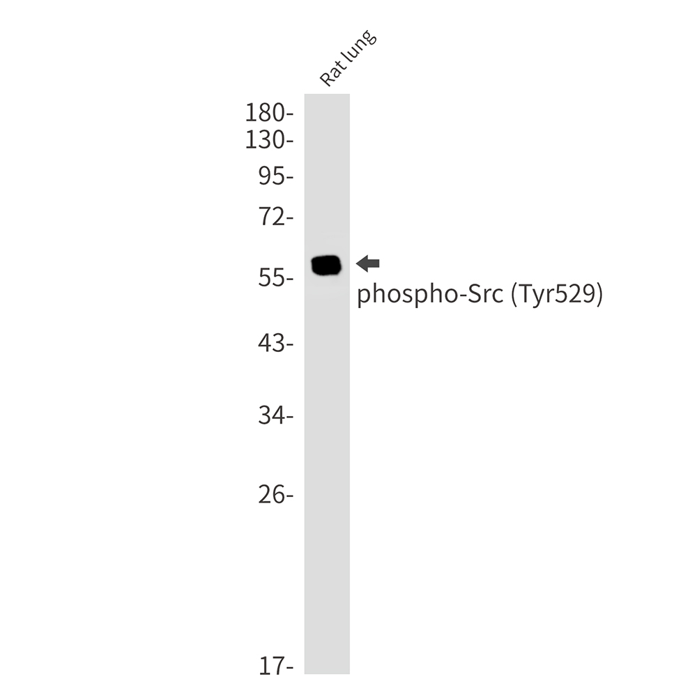 Anti-Phospho-Src (Tyr530) Rabbit mAb [13M94K03]