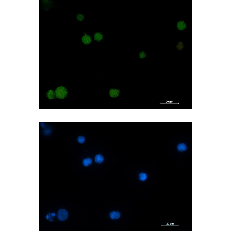 Anti-Rad51 Rabbit mAb [51K82L72]