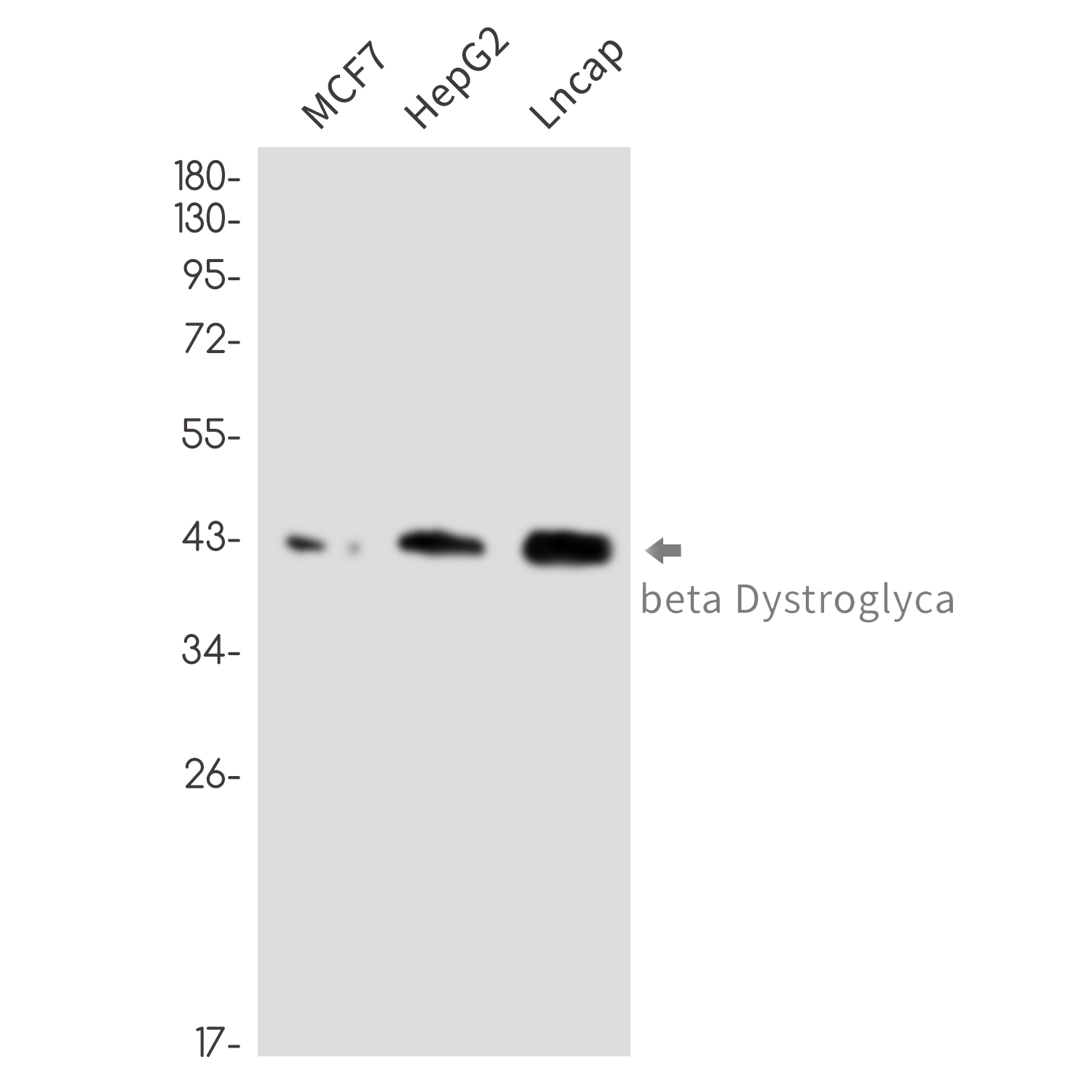Anti-beta Dystroglycan Rabbit mAb [11L67M28]
