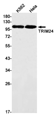 Anti-TRIM24 Rabbit mAb [68M10K72]