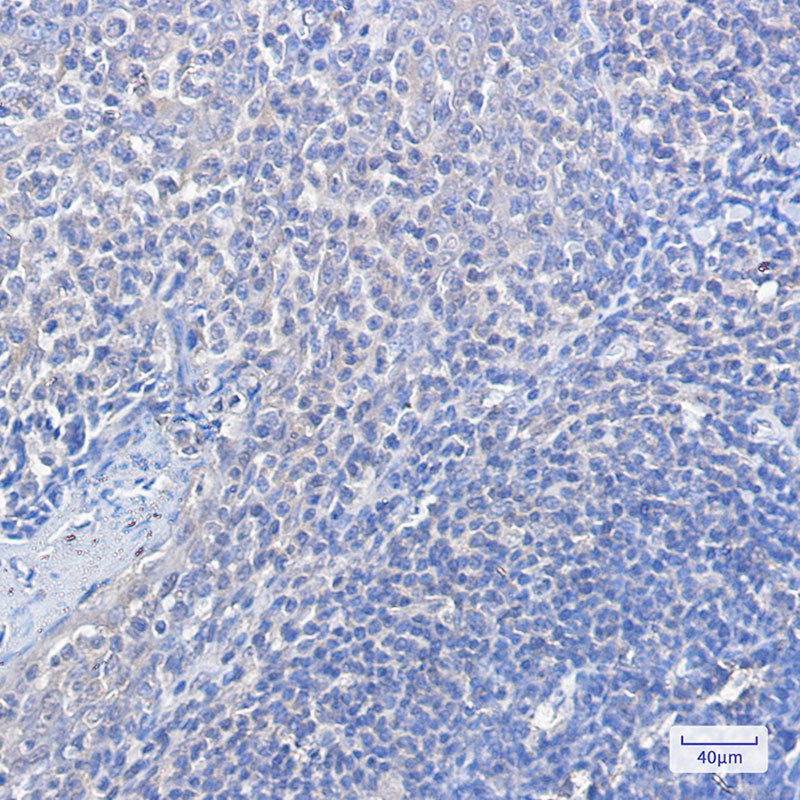 Anti-FOXO1 Rabbit mAb [50M77K34]