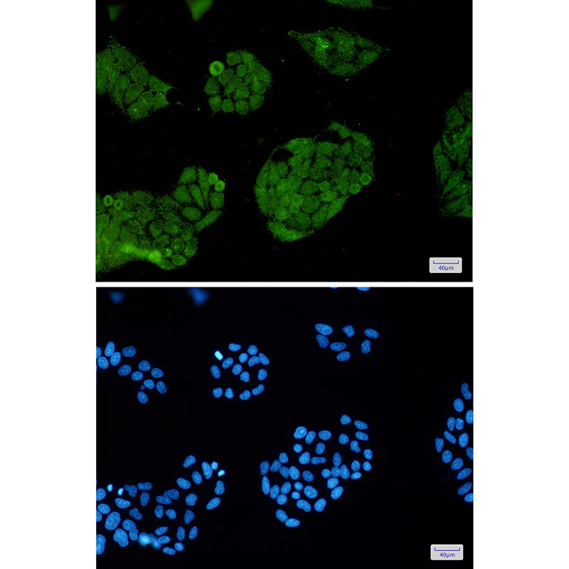 Anti-FOXO1 Rabbit mAb [50M77K34]