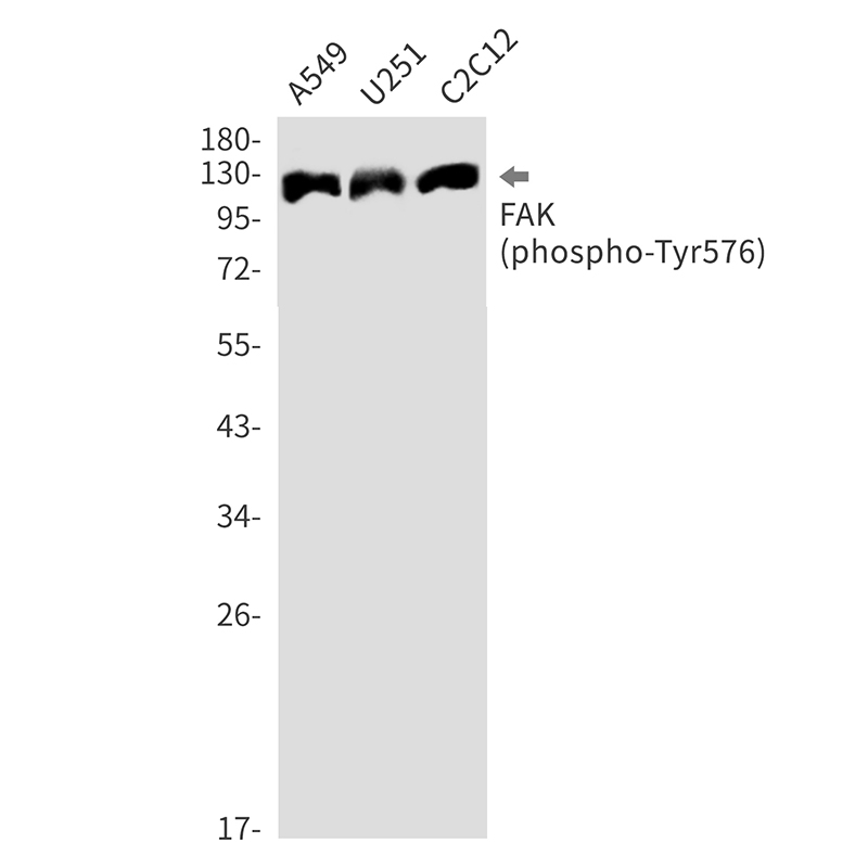 Anti-Phospho-FAK (Tyr576) Rabbit mAb [23L73L89]