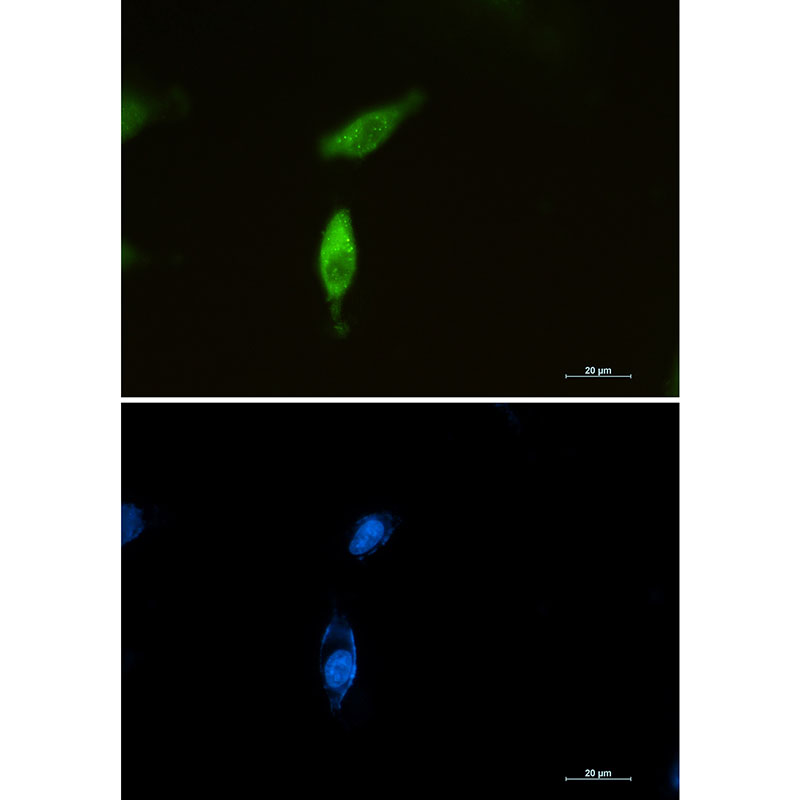 Anti-SQSTM1/p62 Rabbit mAb [52L24K11]