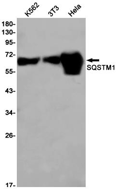 Anti-SQSTM1/p62 Rabbit mAb [52L24K11]