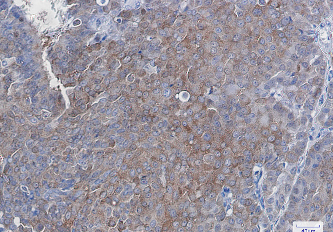 Anti-SQSTM1/p62 Rabbit mAb [52L24K11]