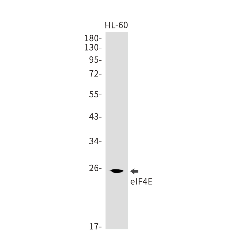Anti-eIF4E Rabbit mAb [60M83K91]