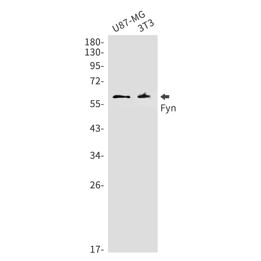Anti-FYN Rabbit mAb [28K36L14]