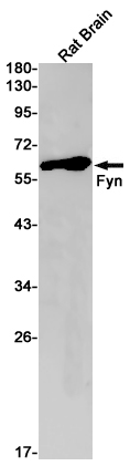 Anti-FYN Rabbit mAb [28K36L14]