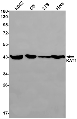 Anti-HAT1/KAT1 Rabbit mAb [78L20L34]