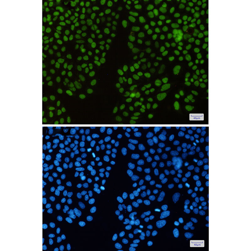 Anti-HAT1/KAT1 Rabbit mAb [78L20L34]
