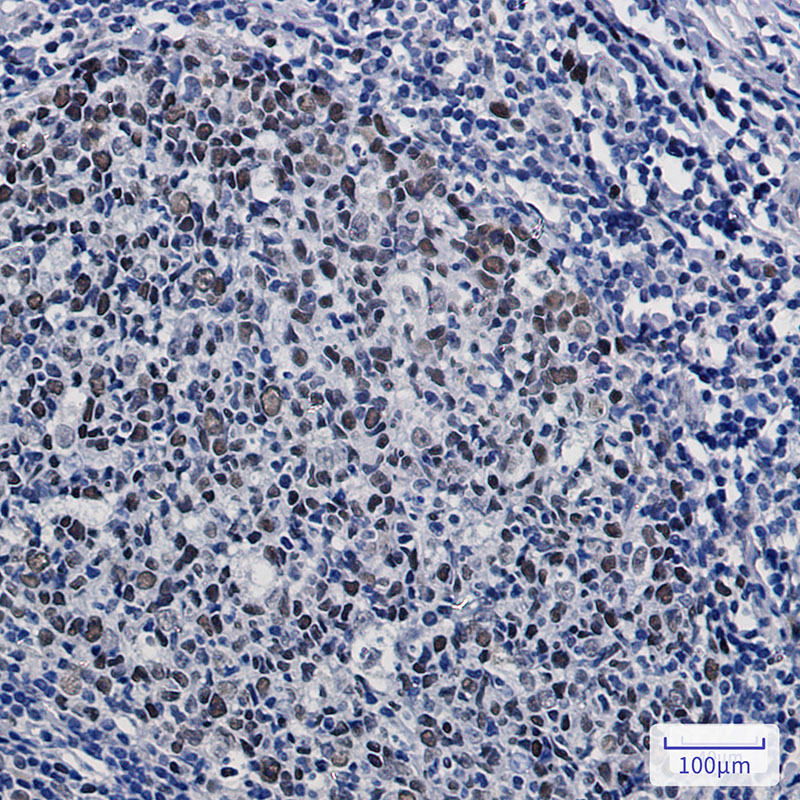 Anti-HAT1/KAT1 Rabbit mAb [78L20L34]