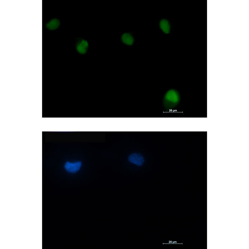 Anti-ATM Rabbit mAb [80M23K30]