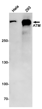 Anti-ATM Rabbit mAb [80M23K30]