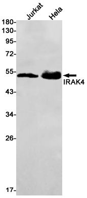 Anti-IRAK4 Rabbit mAb [58K47K17]