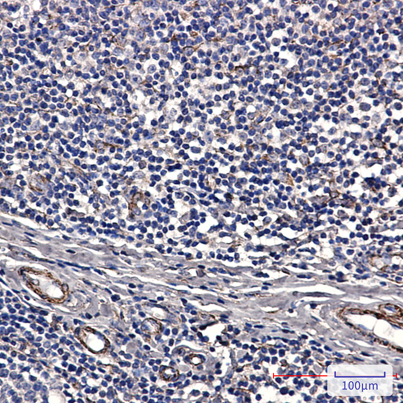Anti-IRAK4 Rabbit mAb [58K47K17]