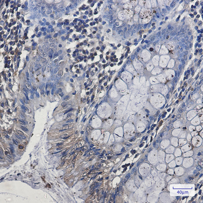 Anti-EHD1 Rabbit mAb [50L54M29]
