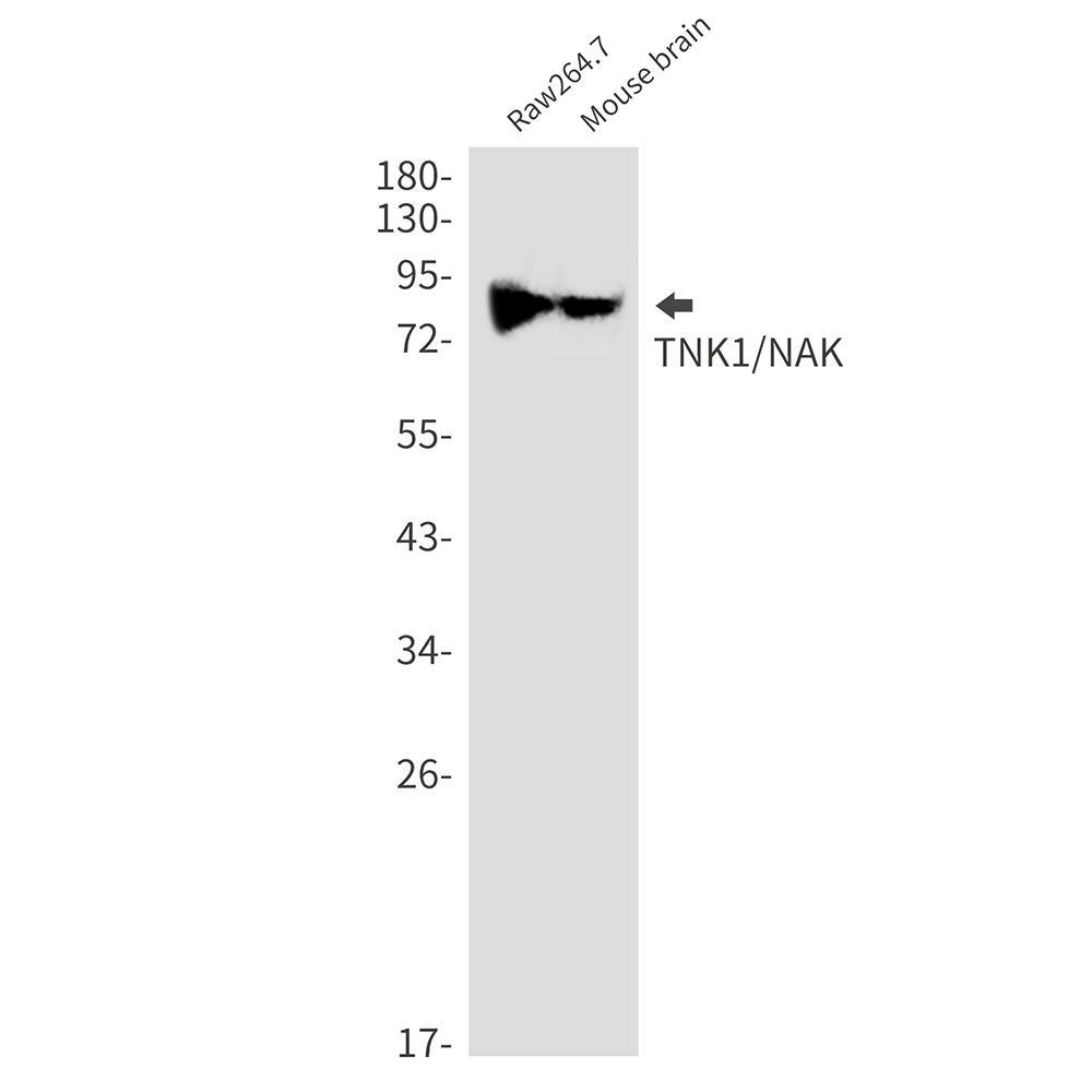 Anti-TBK1 Rabbit mAb [35M01K29]