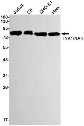 Anti-TBK1 Rabbit mAb [35M01K29]
