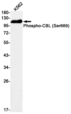 Anti-Phospho-CBL (Ser669) Rabbit mAb [87M75M18]