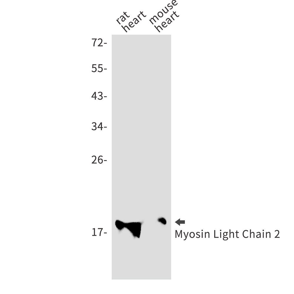 Anti-MYL2 Rabbit mAb [97M47L65]