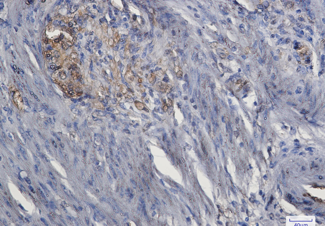 Anti-ERK1 Rabbit mAb [31L89M37]