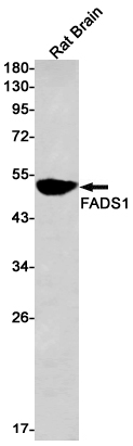 Anti-FADS1 Rabbit mAb [86L96K23]