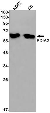 Anti-PDIA1 (PDI) Rabbit mAb [78L44L53]