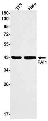 Anti-PAI1 Rabbit mAb [14M34L87]