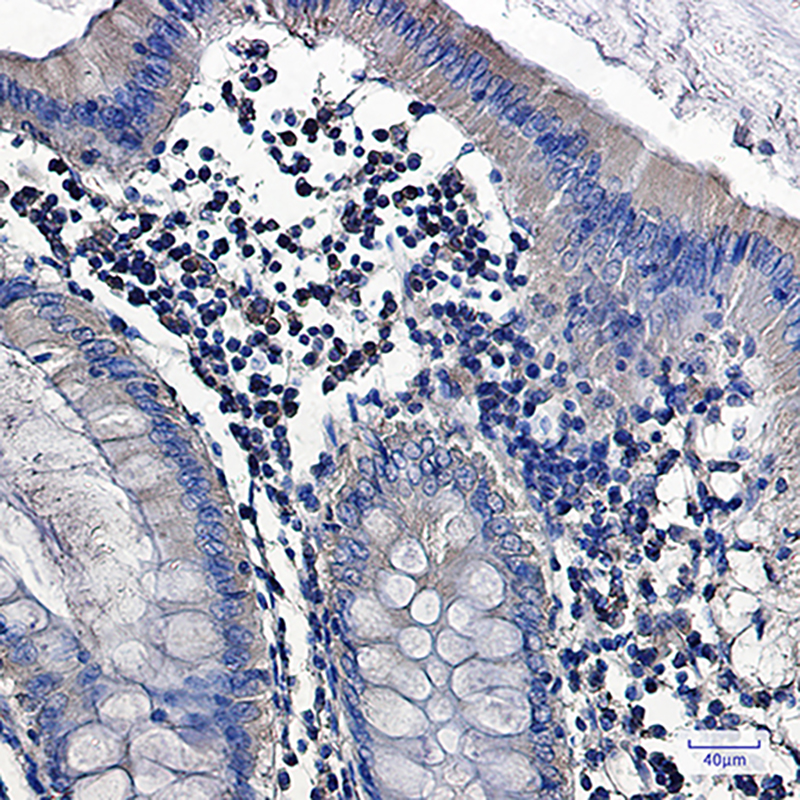 Anti-PKC alpha Rabbit mAb [98M86M88]