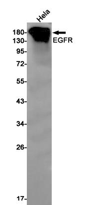 Anti-EGFR Rabbit mAb [79M71M15]