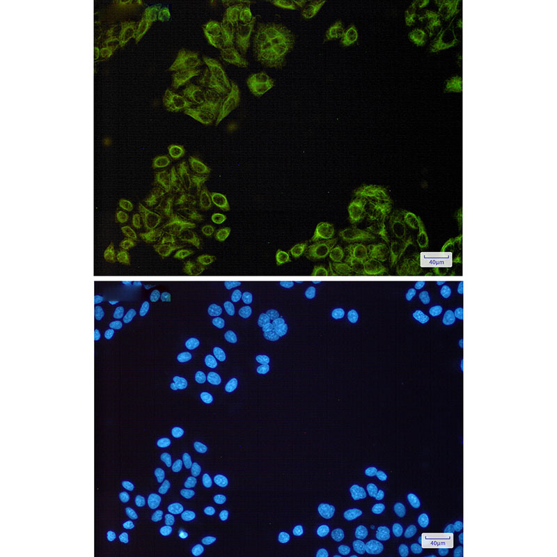 Anti-EGFR Rabbit mAb [79M71M15]