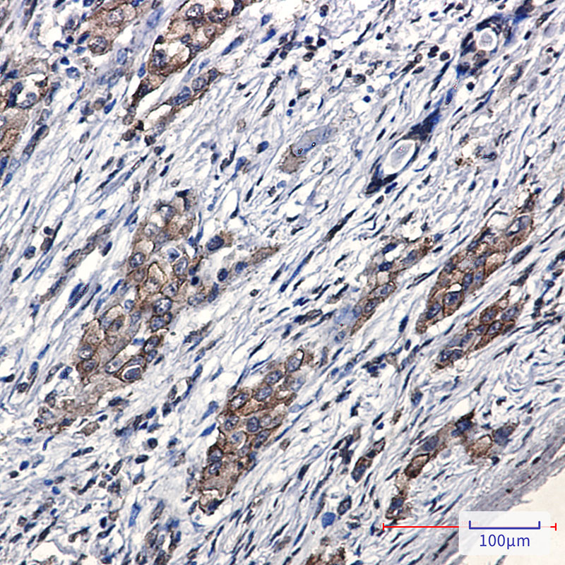 Anti-SARA Rabbit mAb [20K92L42]