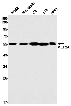 Anti-MEF2A Rabbit mAb [33K77L02]