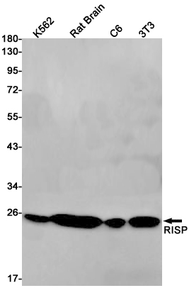 Anti-Complex III Subunit 5 Rabbit mAb [76K86K45]