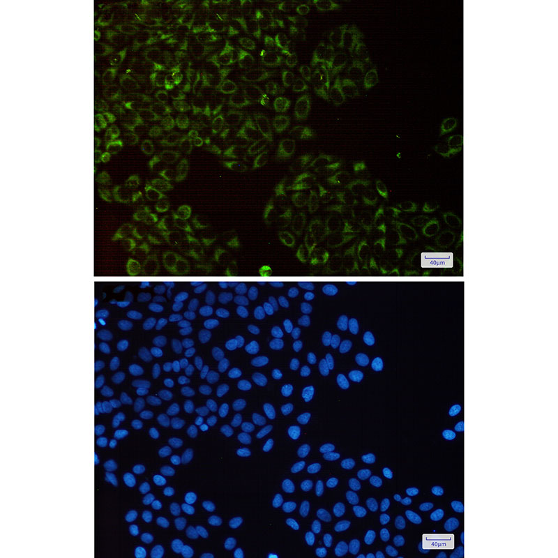 Anti-Complex III Subunit 5 Rabbit mAb [76K86K45]