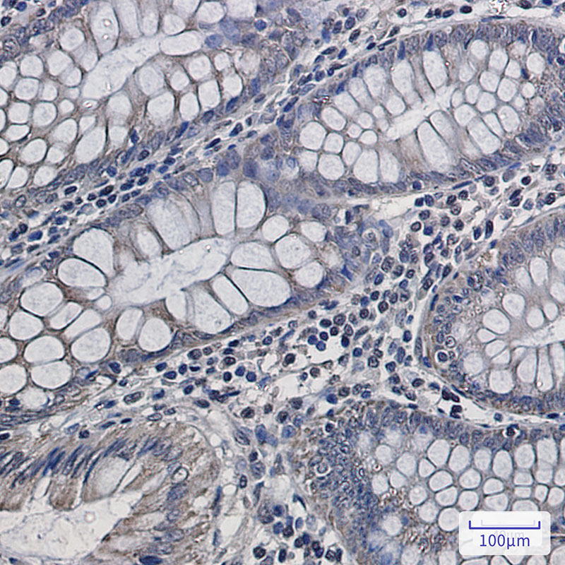 Anti-Complex III Subunit 5 Rabbit mAb [76K86K45]