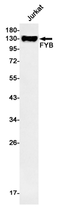 Anti-FYB Rabbit mAb [44M36K26]